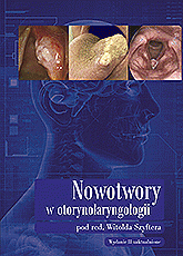 Nowotwory-w-otolaryngologii.gif