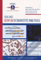 atlas-iaslc-oceny-alk-w-diagnostyce-raka-pluca.jpg