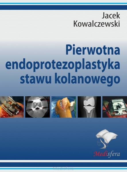 Pierwotnea-endoprotezoplastyka-stawu-kolanowego.jpg