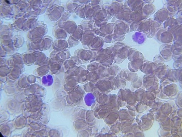 leukocyty.jpg